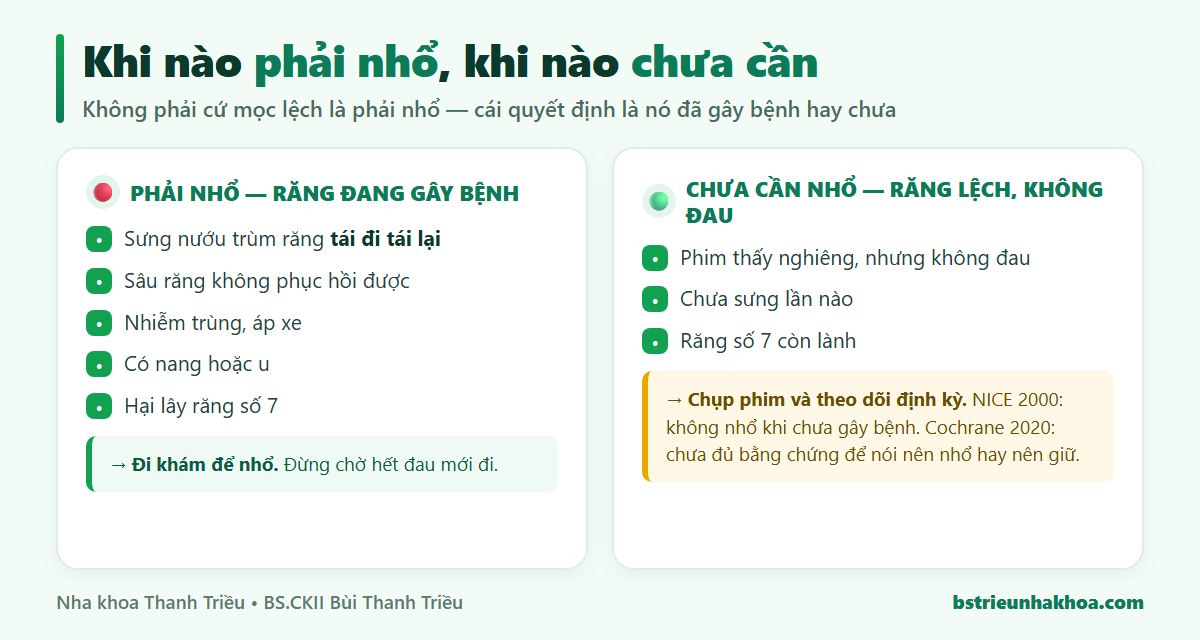 So sánh: răng khôn đang gây bệnh thì cần nhổ, răng khôn mọc lệch không đau thì chưa cần nhổ mà chỉ chụp phim theo dõi