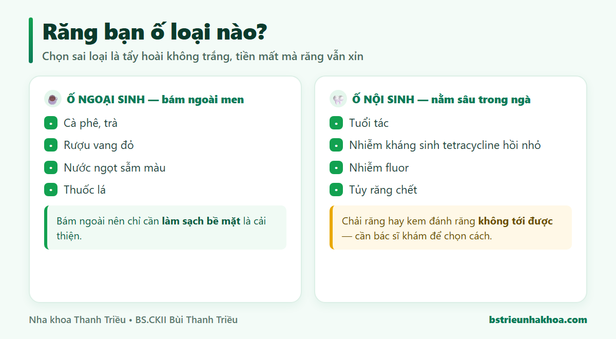So sánh ố ngoại sinh bám ngoài men răng do cà phê trà thuốc lá với ố nội sinh nằm sâu trong ngà răng do tuổi tác, tetracycline, nhiễm fluor