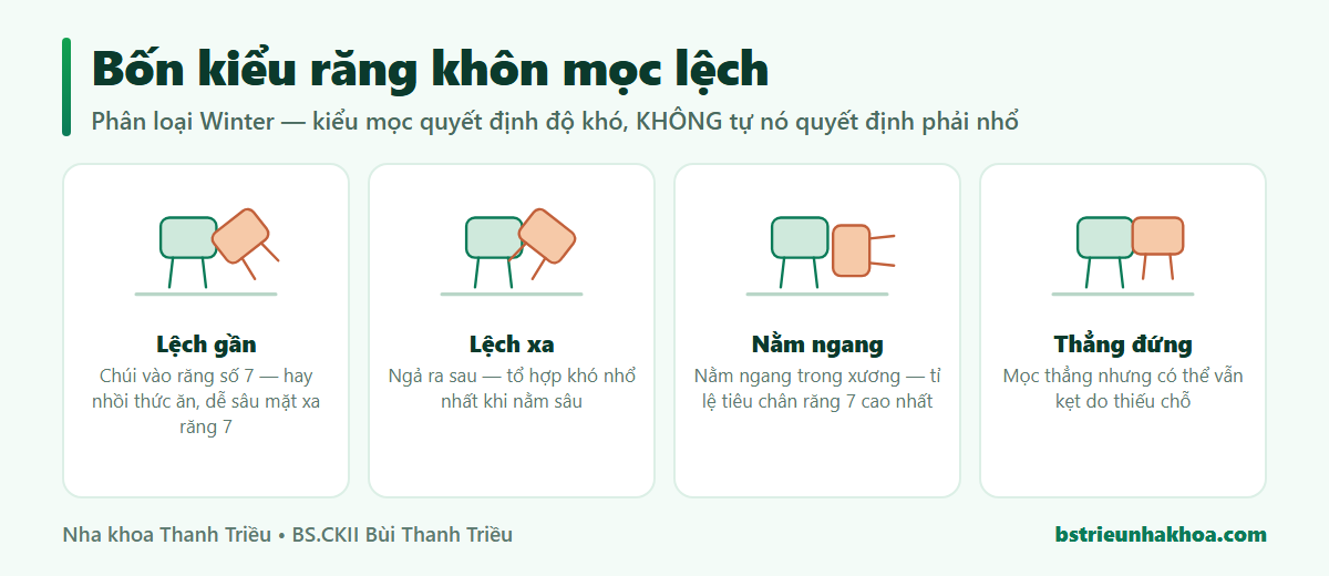 Sơ đồ bốn kiểu răng khôn mọc lệch theo phân loại Winter: lệch gần, lệch xa, nằm ngang, thẳng đứng
