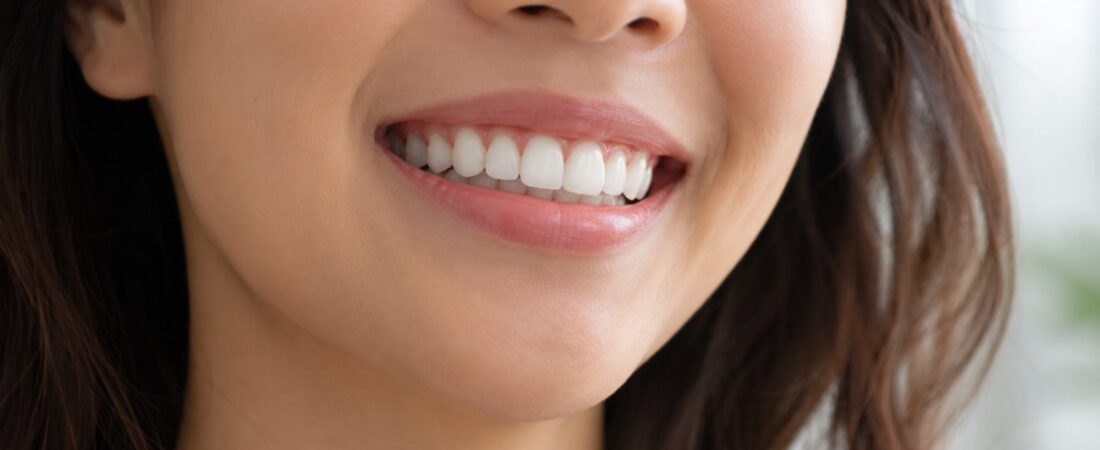 5 Cách Làm Trắng Răng An Toàn: Bác Sĩ Chỉ Cách Chọn Đúng