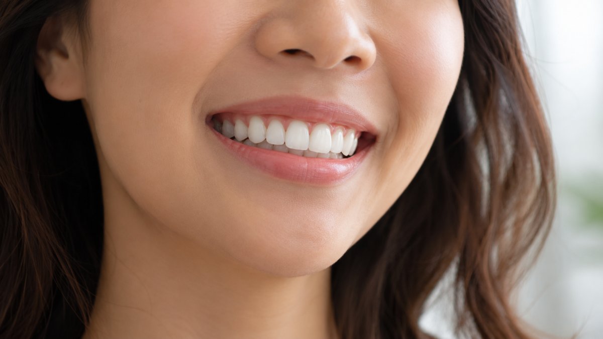 Cận cảnh nụ cười với hàm răng đều, sạch và trắng tự nhiên, nướu hồng khoẻ