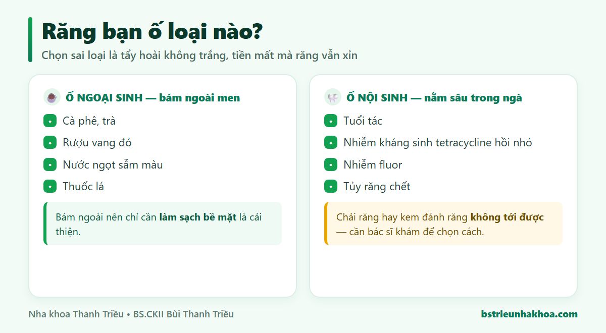 So sánh ố ngoại sinh bám ngoài men răng do cà phê trà thuốc lá với ố nội sinh nằm sâu trong ngà răng do tuổi tác, tetracycline, nhiễm fluor