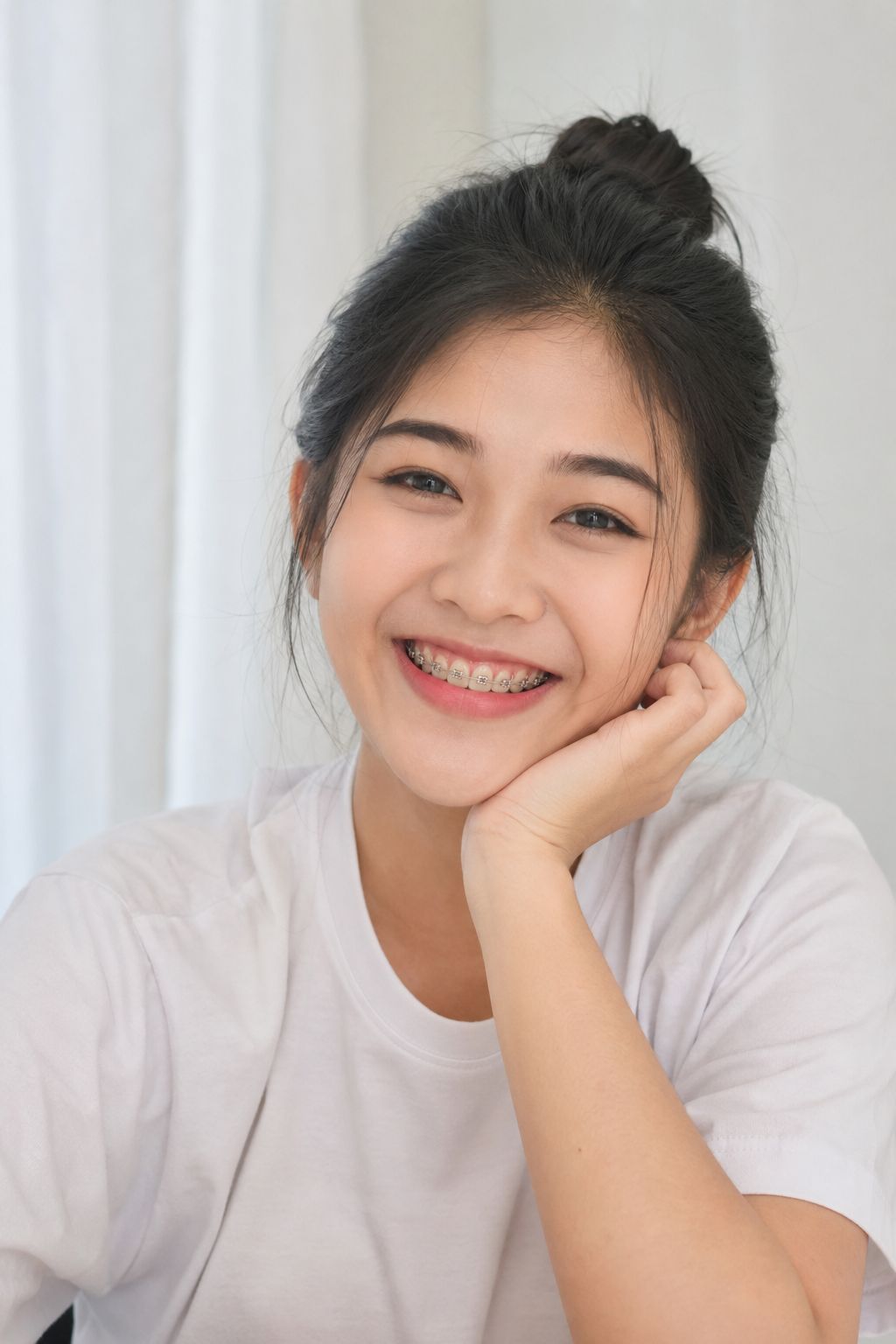 Niềng răng mất bao lâu? Thời gian từng trường hợp